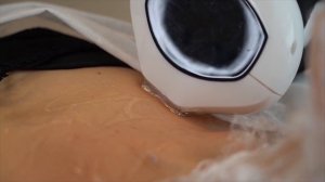 IPL-фотоомоложение Lumecca в центре Yourwings