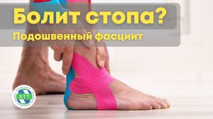 ✅Боль в стопе. Подошвенный фасциит. Тейпирование стопы.