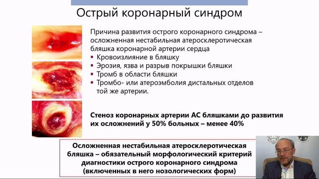 Ишемическая болезнь сердца. 26.11.19 смотреть онлайн