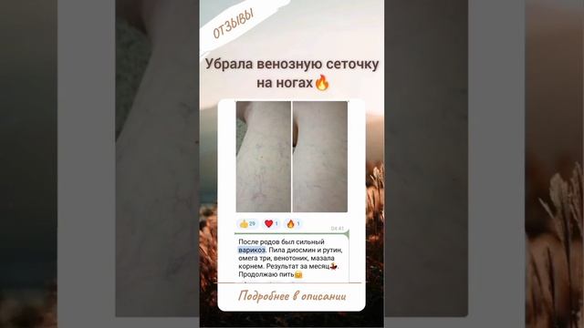 Убрала венозную сеточку на ногах без дорогих косметических процедур!!!! Подробнее в описании ?