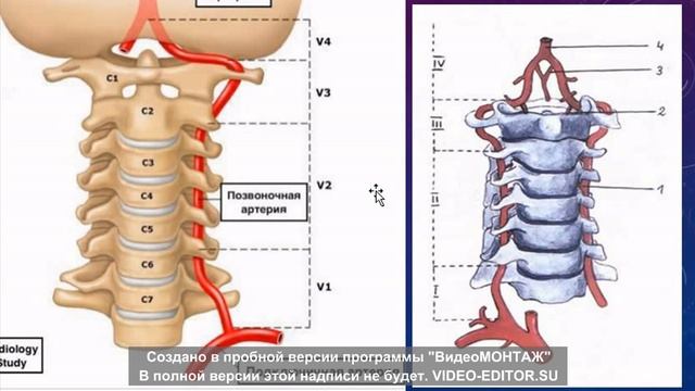 ПОДКЛЮЧИЧНАЯ АРТЕРИЯ (a.subclavia)