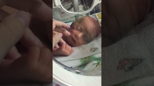 малыш 36. новорожденные. ребенок на 36 неделе беременности. 36 неделя недель беременности роды. ребенок на 36 неделе беременности.