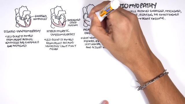 Cardiovascular Disease Overview
