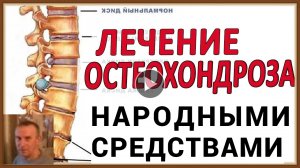 ЛЕЧЕНИЕ ОСТЕОХОНДРОЗА НАРОДНЫМИ СРЕДСТВАМИ