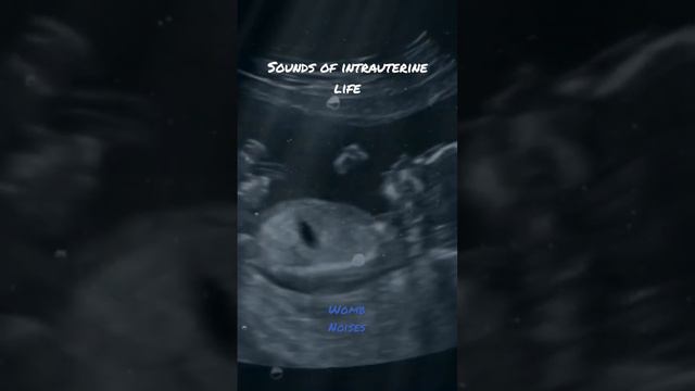 Noises and Sounds of the Womb