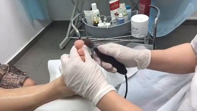 Аппаратный педикюр
