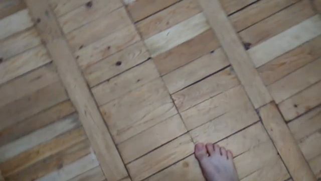 Спустя год после травмы голеностопа