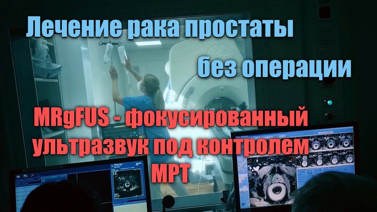 Лечение рака предстательной железы без операции и побочных эффектов