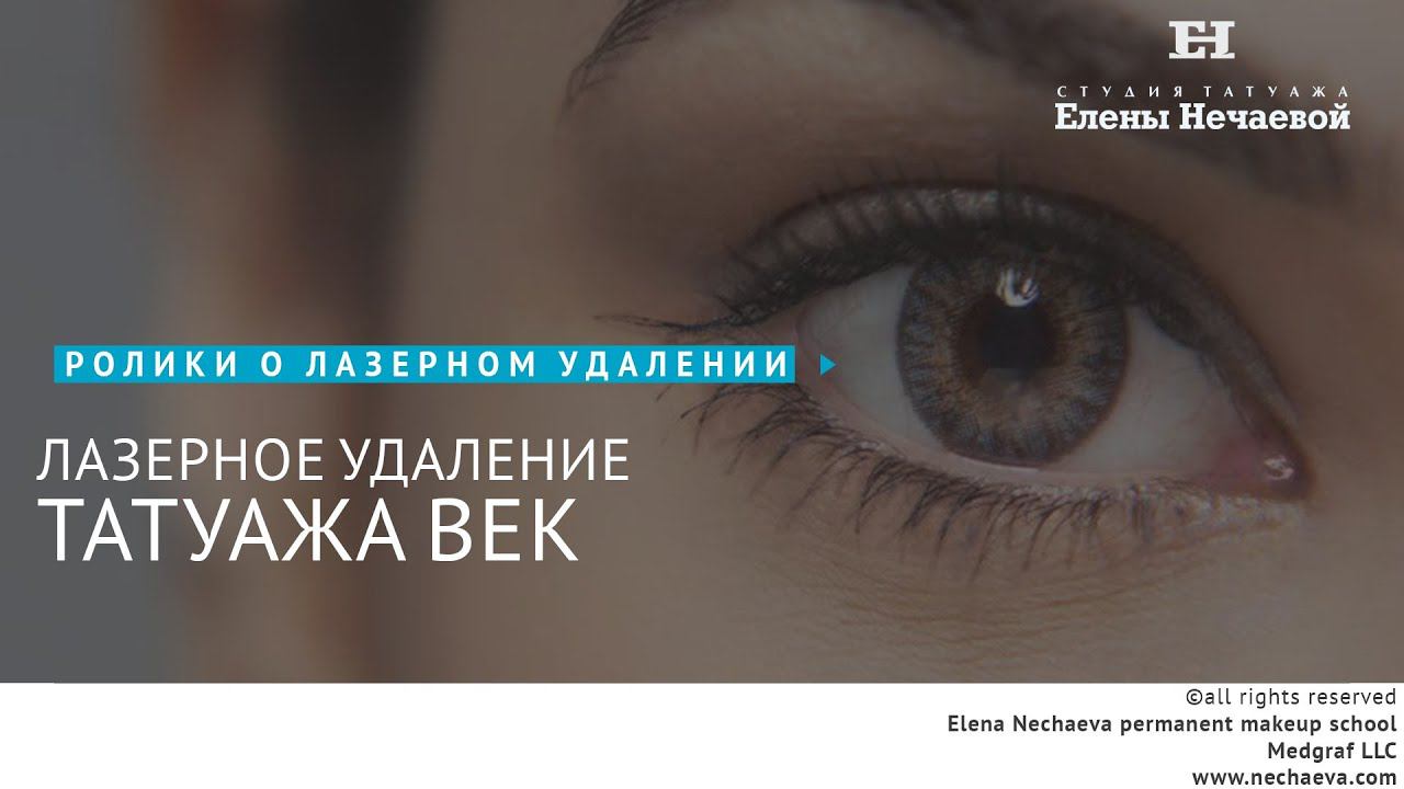 Лазерное удаление татуажа век. #татуаж #лазерноеудаление