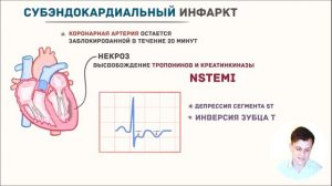 ЭКГ за 100 минут №7: Ишемия и Инфаркт на ЭКГ