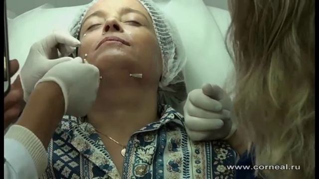 3D лифтинг под глазами смотреть онлайн