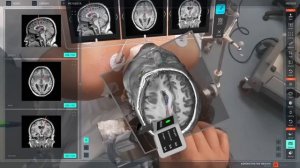 ⚡Инновации в медицине: Medivis и их революционная технология 🌟