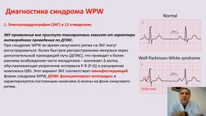 WPW синдром