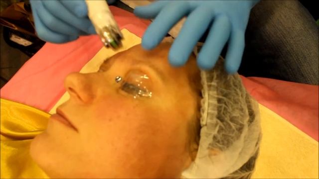 Dermafrac. Интершарм 2013
