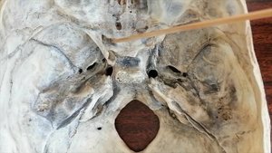 I, II и VIII пары черепно-мозговых нервов