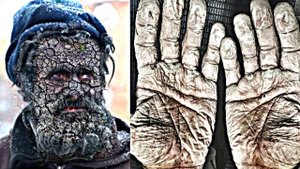 Этот Мужчина Не Мылся Более 60 Лет