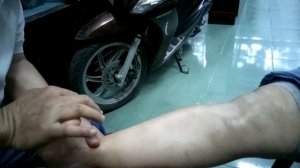 Мастер-класс от доктора Ли. Самостоятельный массаж-поглаживание при варикозе