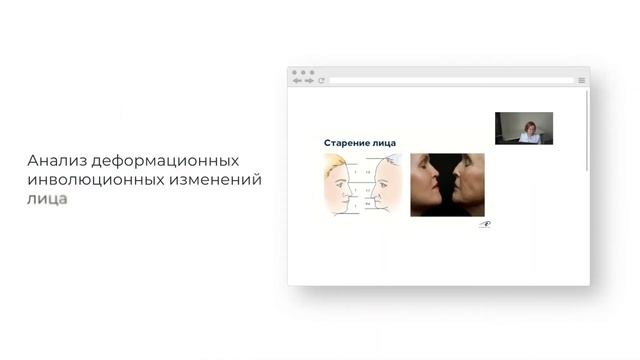 Послойная эстетическая реабилитация возрастных изменений верхней и средней третей лица