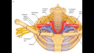НАДКЛЮЧИЧНЫЙ ДОСТУП  Пункция подключичной вены