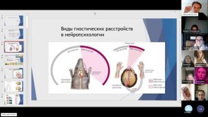 5_06.10.23_Клочко_Нейропсихология