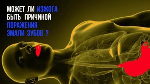 Эрозия эмали: что это такое, как распознать❓