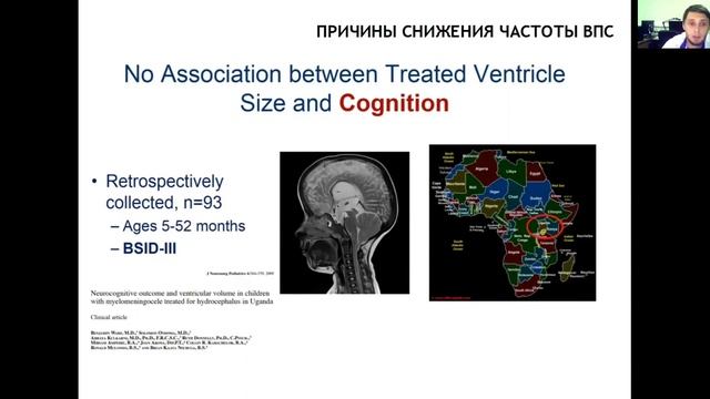 Гидроцефалия при спина бифида у детей #спинабифида #спинабифиданеприговор #гидроцефалия #spinabifid