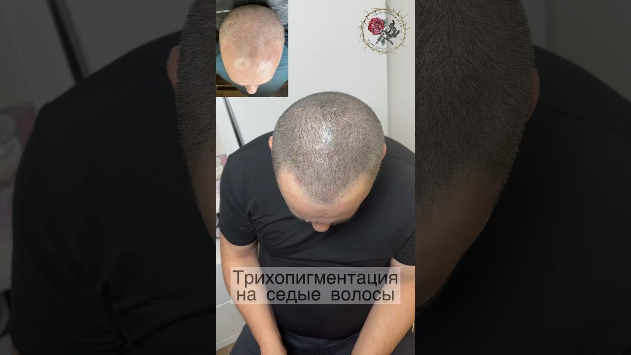 Скрываем седину и поредение. Трихопигментация на седые волосы. Лучше чем пересадка. SMP tattoo