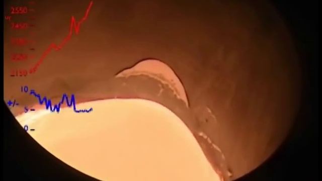 Vacuum Furnace Induction Melt Cycle смотреть онлайн