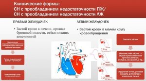Сердечная недостаточность