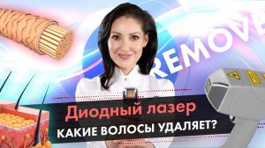 Какие волосы удаляет диодный лазер, а какие нет? Эпиляция диодным лазером LASERTECH