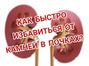 ##Страдаете от камней в почках? Узнайте, как избавиться от них без операции!##