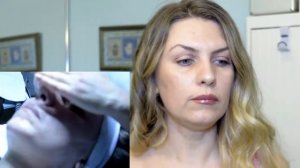 АЛМАЗНАЯ МИКРОДЕРМАБРАЗИЯ. Мой ОПЫТ. ПЛЮСЫ и МИНУСЫ. Diamond microdermabrasion. My experience