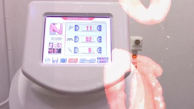 Участница проекта Зарина. Волосы на теле - для меня реально проблема смотреть онлайн