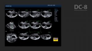 УЗИ аппарат Mindray DC-8