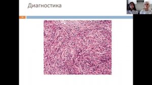 КЛИНИКО-ЭПИДЕМИОЛОГИЧЕСКИЕ ОСОБЕННОСТИ САРКОМЫ КАПОШИ У ПАЦИЕНТОВ С ВИЧ В САРАТОВСКОЙ ОБЛАСТИ