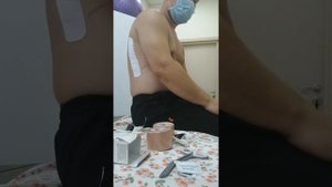 Кинезиотейпирование при переломах ребер.