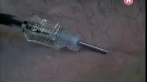 Наука 2.0 Большой скачок. Тайна крови.