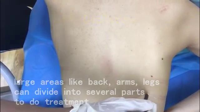 Sincoheren diode laser install and operate details guide смотреть онлайн