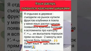 Болит язык. Чем лечить? 🥺