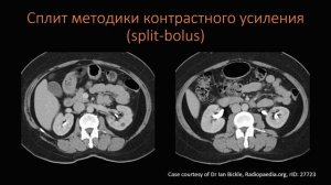 КТ Абдоминальная визуализация 16 Лекция «КТ почек и МВС» Лектор Пихута Д А