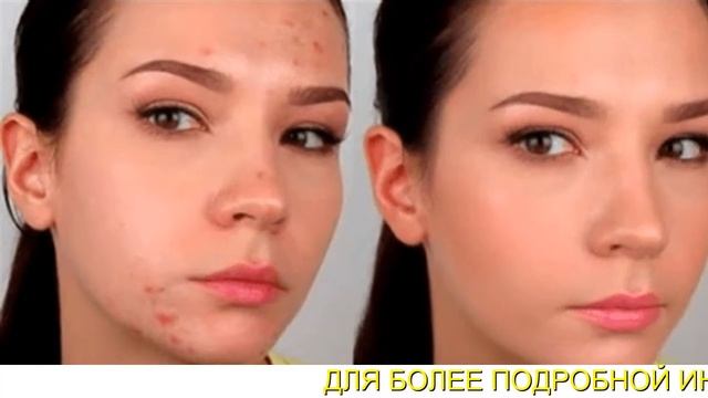 Ламитон Тональный Крем Где Купить смотреть онлайн