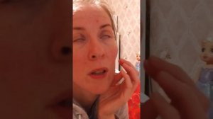 Рак молочной железы Карценома  инвазивная внутрипротоковая стадия 1 а