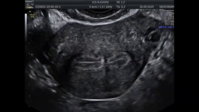 МЭХО 3 смотреть онлайн