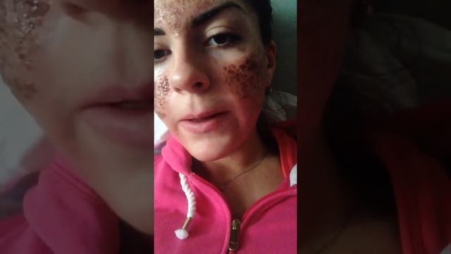 После лазерной шлифовки Fraxel Repair 5 день! Instagram: anna.cosmosss смотреть онлайн