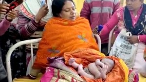 Ребенок родился с четырьмя руками и четырьмя ногами. Вот каким он стал спустя время!