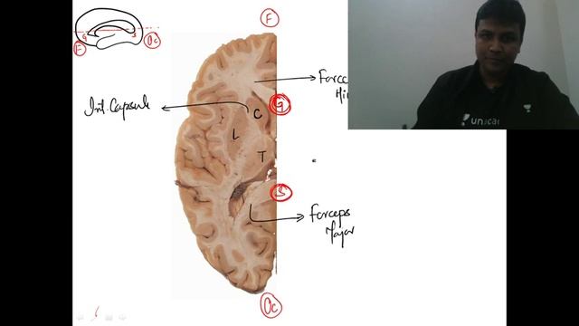 NEET PG | Anatomy | Cadaveric Images of Neuroanatomy by Dr. Mohammed Azam