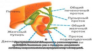 Как лечить воспаление желчного пузыря