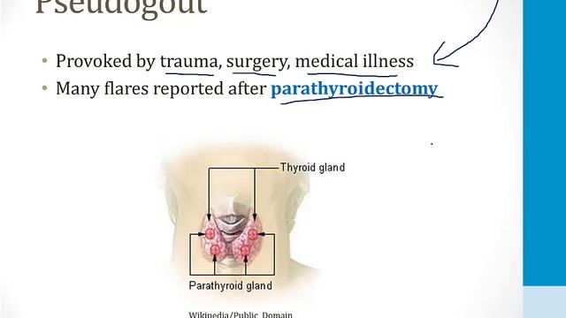 Опорно-двигательный аппарат USMLE - 3. Патология - 8.Отложение пирофосфата кальция