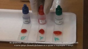 1567 Определение группы крови