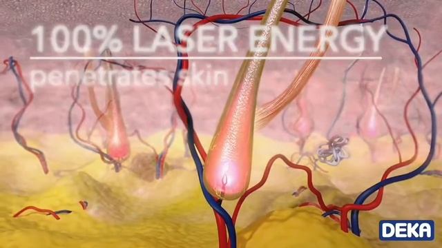 Motus Laser смотреть онлайн